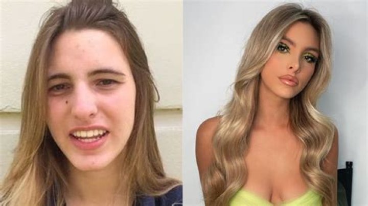 Before And After Pictures Examined!